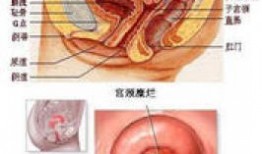 宫颈糜烂微波术视频,微波术治疗宫颈糜烂操作步骤详解