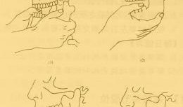 下颌关节脱位复位视频,下颌关节脱位复位操作步骤详解